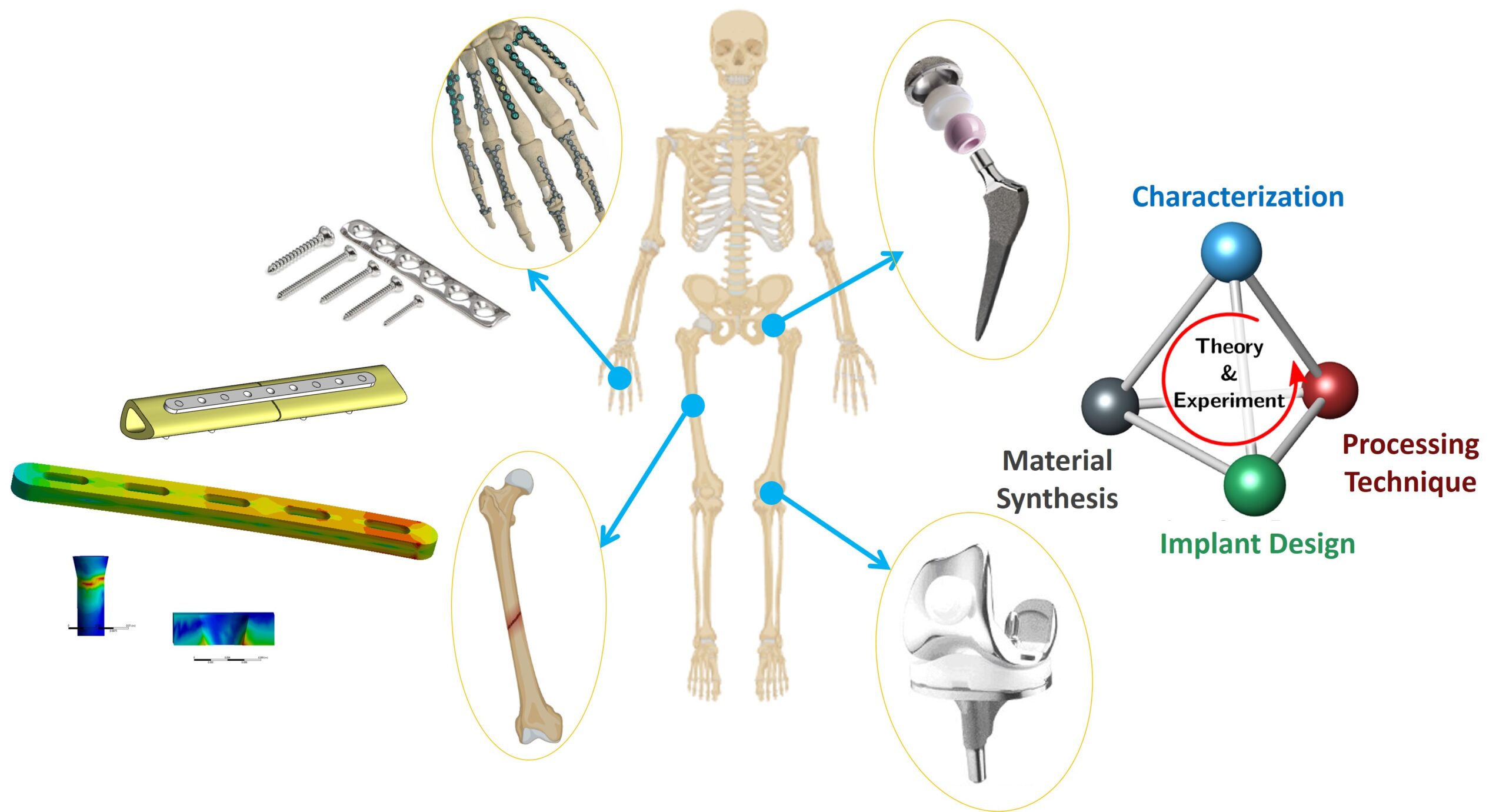 Biomedical Implants